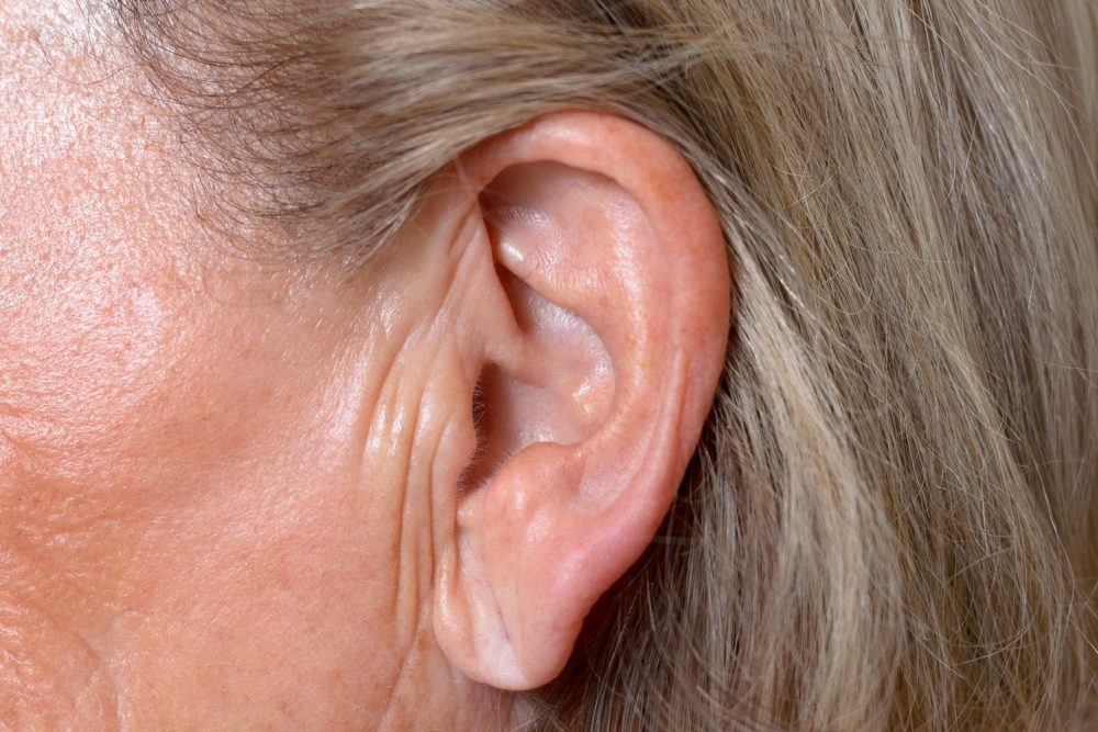 crease in earlobe