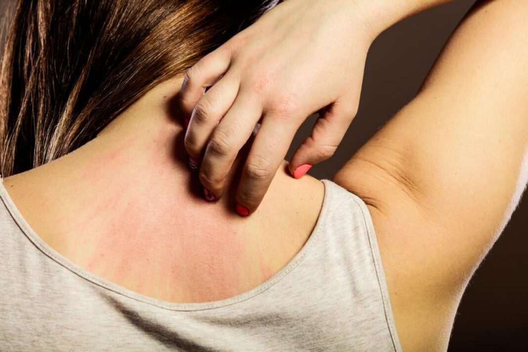 Scratch That Itch: Unraveling the Mystery of Back Itchiness