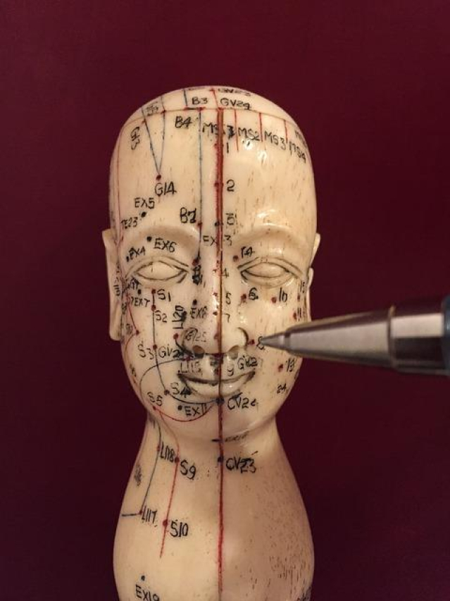 Top Acupuncturists in Tucson: Expert Healing