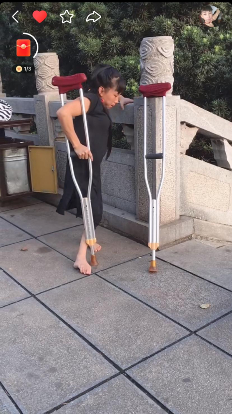 Understanding Chondrosis: Symptoms, Causes, and Treatment