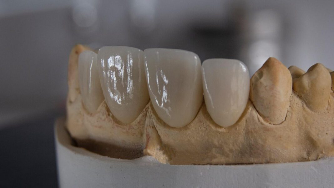 Discover the Quality Care at Northcutt Dental