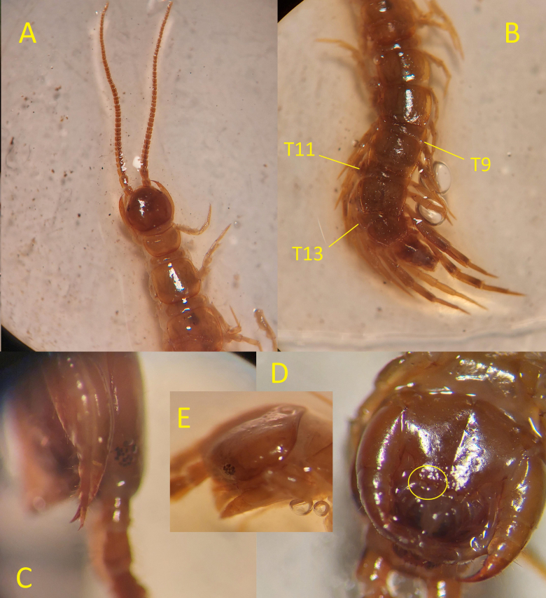 Understanding Flat Stool: Causes and Treatment