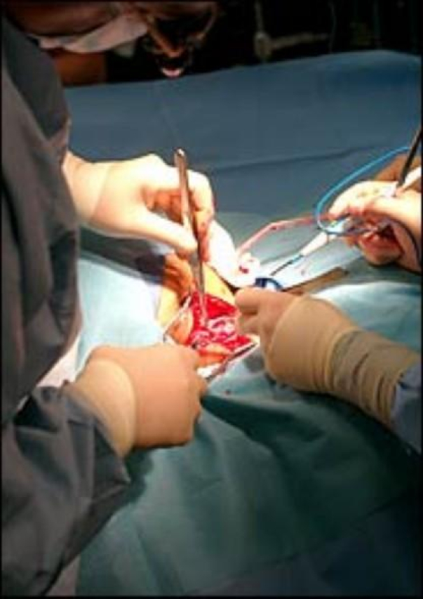 Discover the Expert Care at Stony Brook Neurology