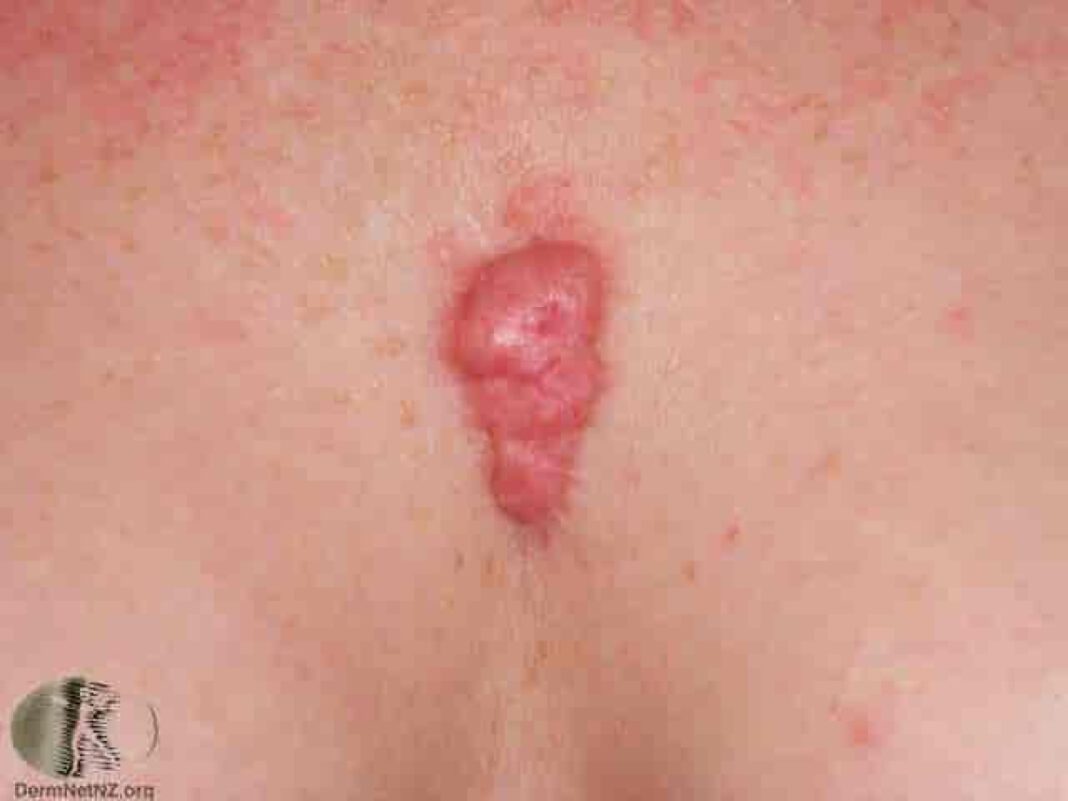 Unlock the Secrets of Ganger Dermatology: Skin Solutions