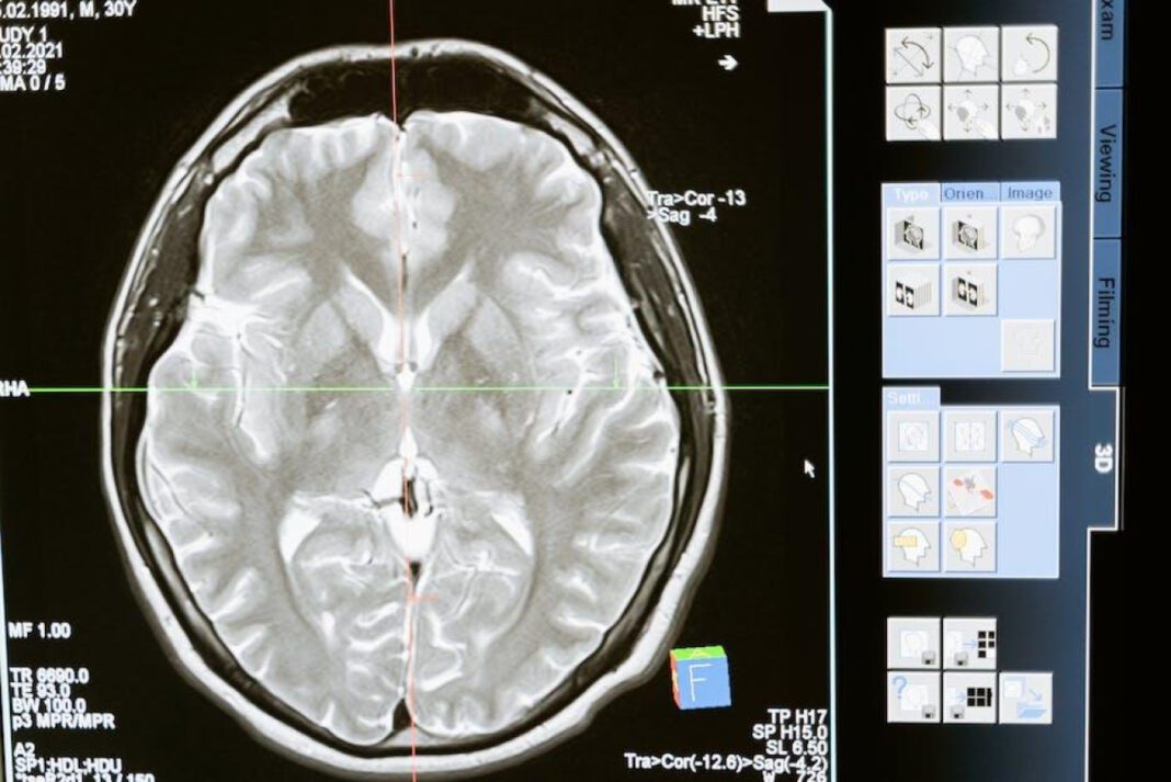 Unlock the Cost: How Much is a Brain MRI?