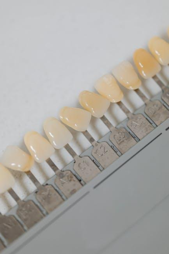 Beyond the Tooth Fairy: The True Cost of Dental Implants