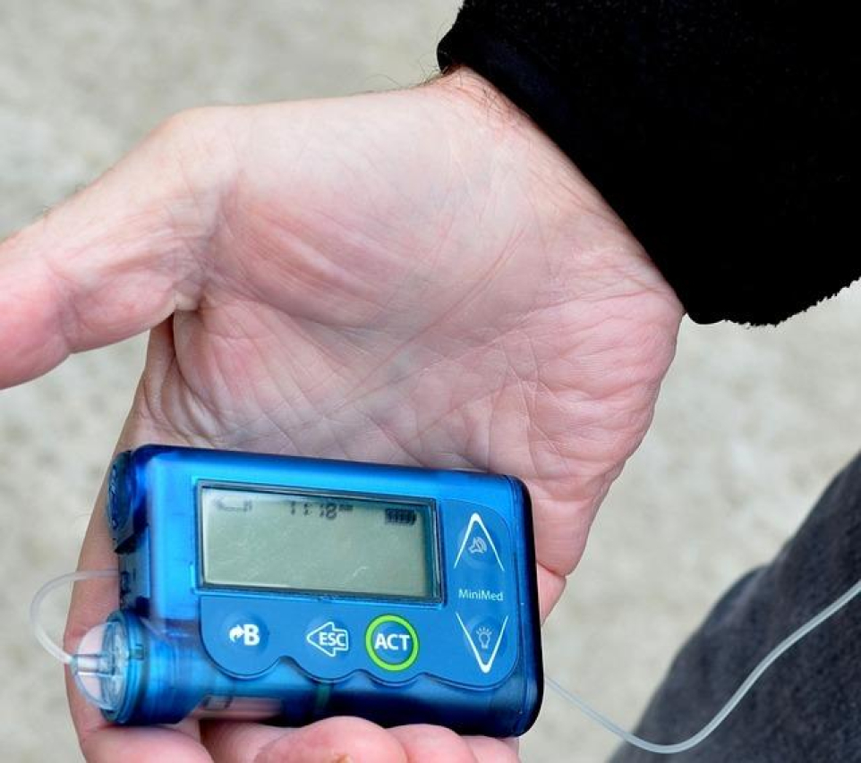 The Cost of Insulin Pump: Factors Affecting Prices
