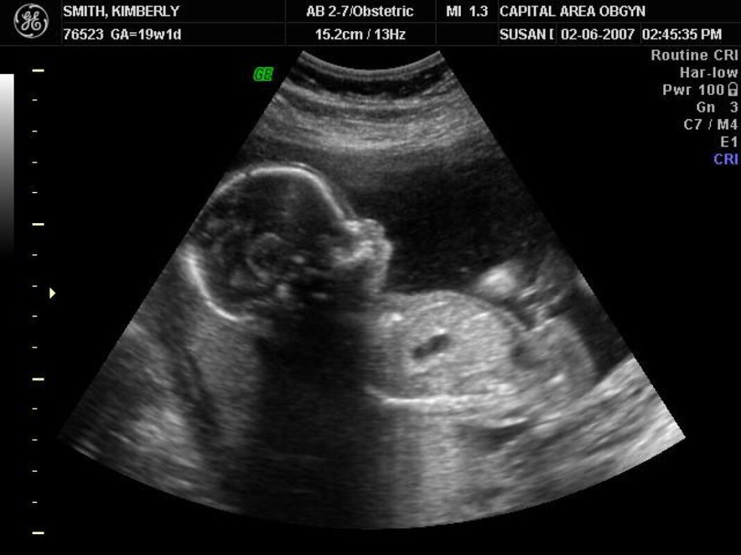 Affordable Ultrasound Costs – No Insurance Required