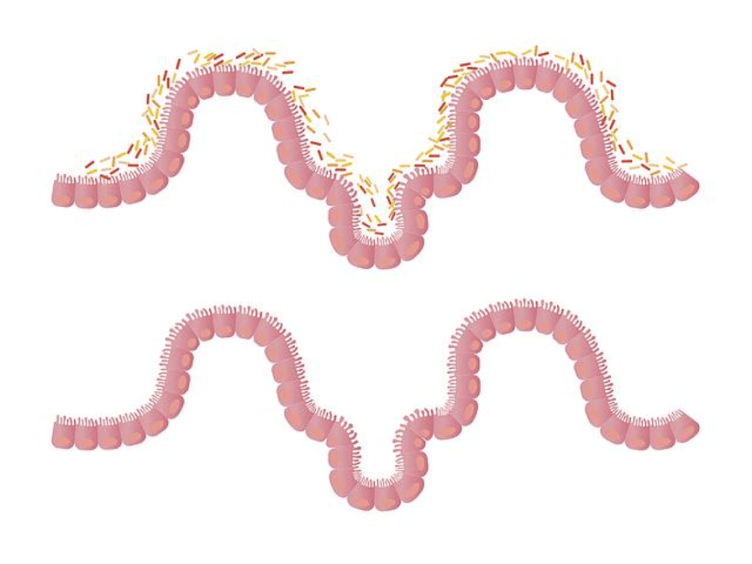 The Lowdown on Your Gut: Why Your Darm Deserves Some Love