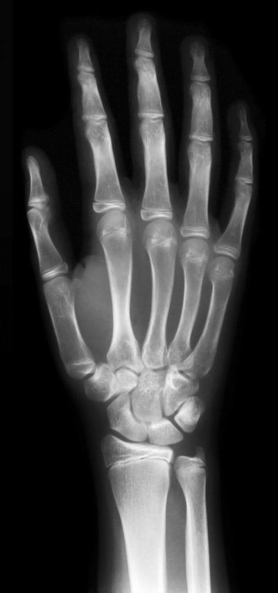 The Unbelievable X-Ray That Shocked Doctors