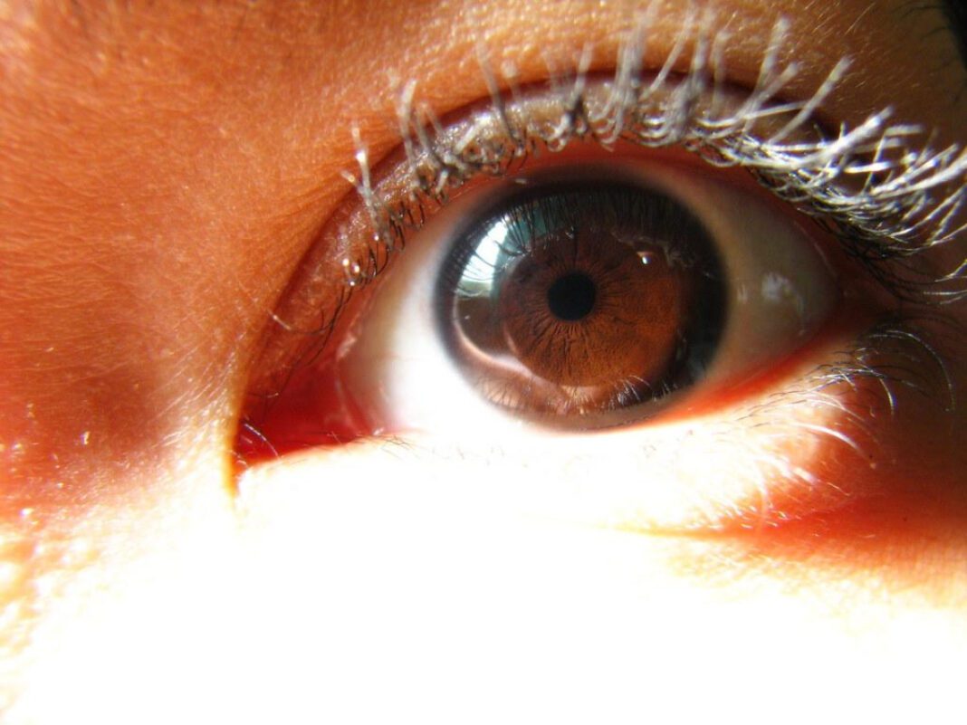 Enhancing Brown Eyes: Best Eyeshadow Colors